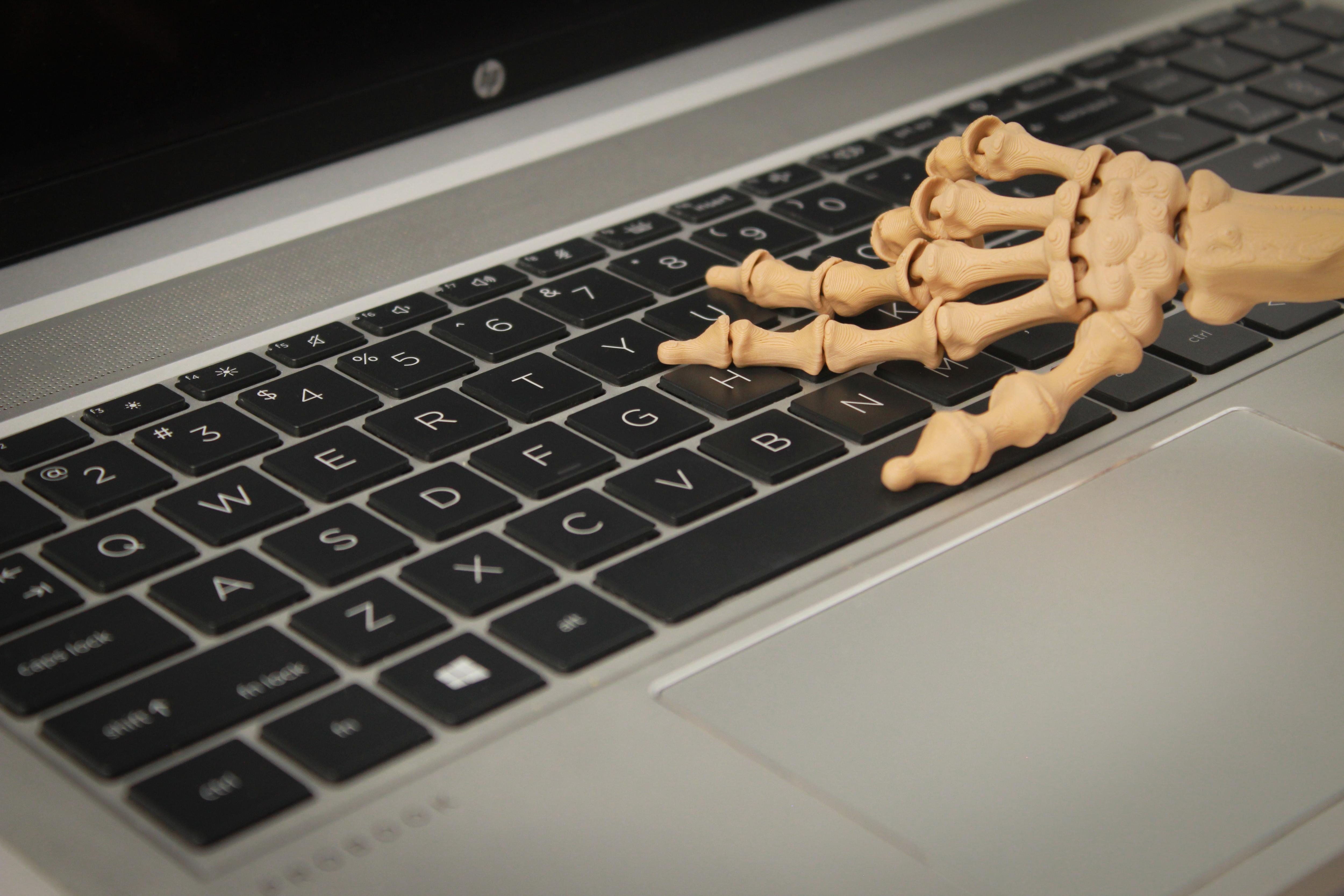 Skelly Hand - Articulating Pencil Topper